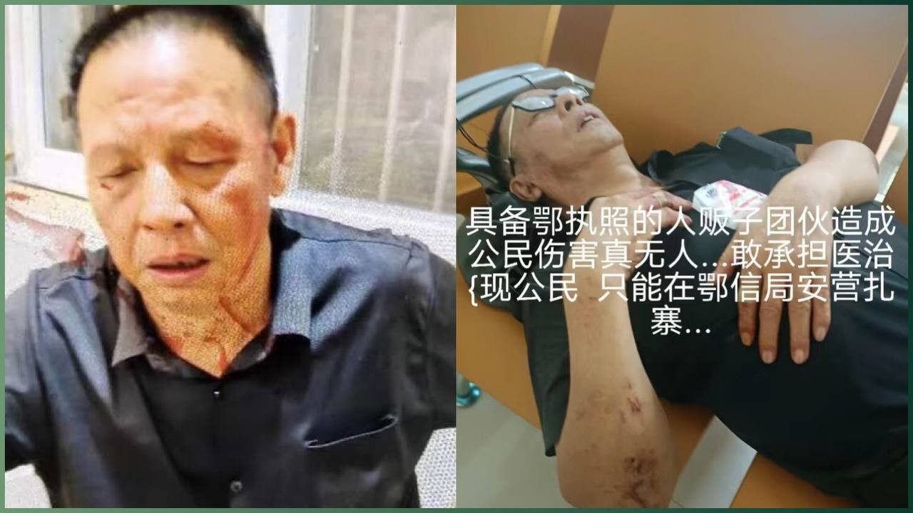 湖北访民童斌北京信访遭绑架回武汉，身体重伤求医无门，警方拒绝立案引发公愤